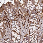 Anti-NADSYN1 Antibody