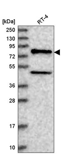 Western blot analysis in human cell line RT-4.