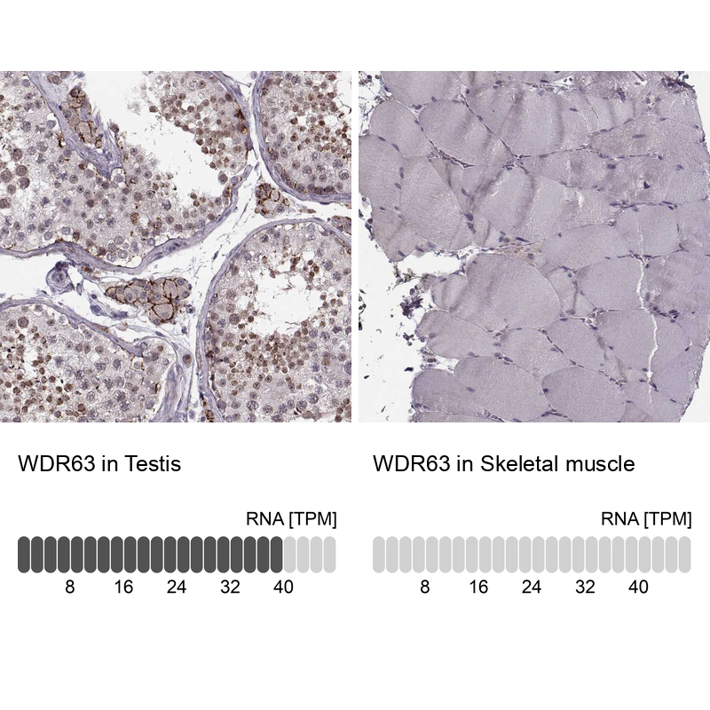 Anti-WDR63 Antibody