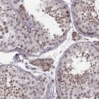 Immunohistochemical staining of human testis shows strong cytoplasmic/ membranous positivity in spermatids and leydig cells.
