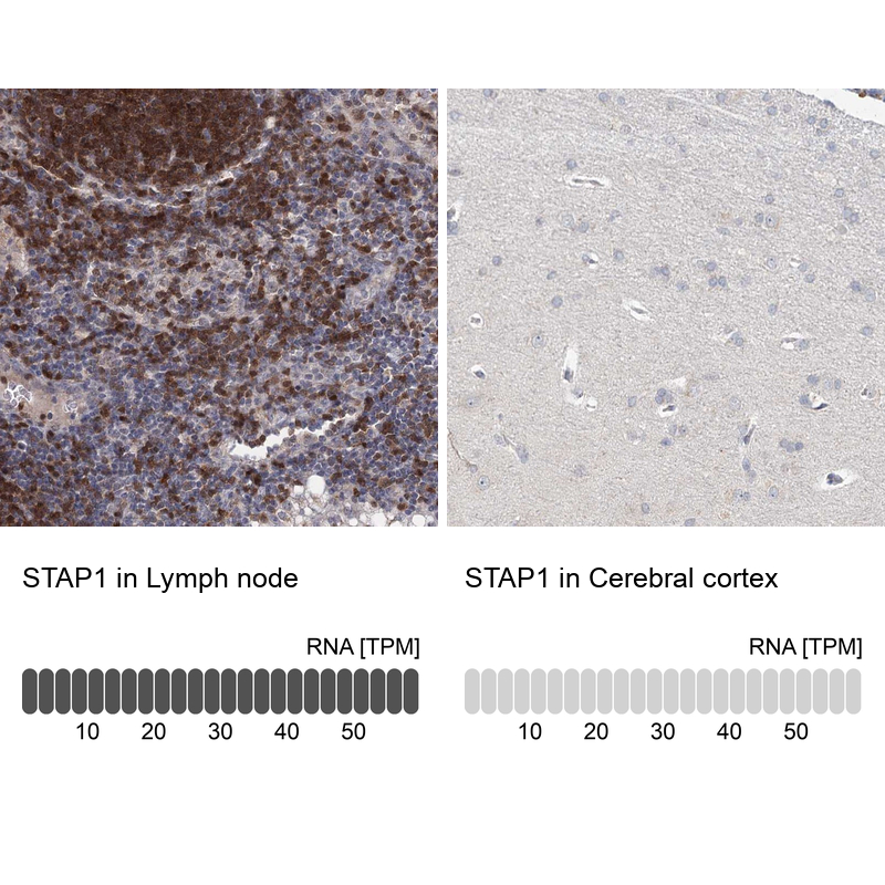 Anti-STAP1 Antibody