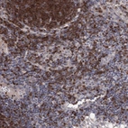 Immunohistochemical staining of human lymph node shows high expression.