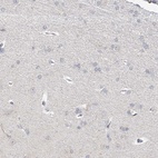 Anti-STAP1 Antibody