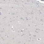 Immunohistochemical staining of human cerebral cortex shows low expression as expected.