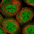 Immunofluorescent staining of human cell line A-431 shows localization to nucleoplasm & vesicles.