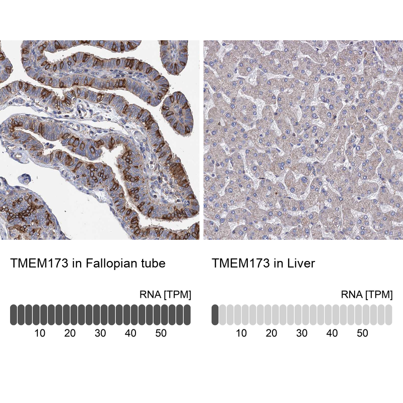 Anti-TMEM173 Antibody