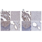 Immunohistochemical staining of human fallopian tube, liver, lymph node and prostate using Anti-TMEM173 antibody HPA038534 (A) shows similar protein distribution across tissues to independent antibody HPA038116 (B).