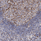 Immunohistochemical staining of human lymph node shows strong membranous positivity in follicular dendritic cells.