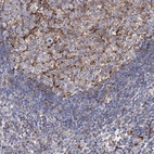 Immunohistochemical staining of human lymph node shows strong membranous positivity in follicular dendritic cells.