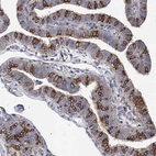 Immunohistochemical staining of human Fallopian tube shows strong cytoplasmic and membranous positivity in glandular cells.