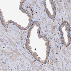 Immunohistochemical staining of human prostate shows moderate membranous positivity in basal layer glandular cells.