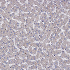 Immunohistochemical staining of human liver shows no positivity in hepatocytes as expected.
