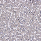 Immunohistochemical staining of human liver shows no positivity in hepatocytes as expected.