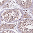 Anti-TTC12 Antibody