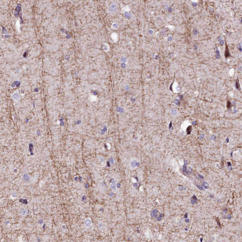 Anti-FCHSD2 Antibody