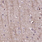 Anti-FCHSD2 Antibody