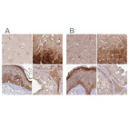 Anti-HAL Antibody