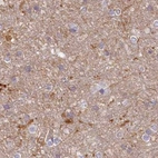 Immunohistochemical staining of human cerebral cortex using Anti-HAL antibody HPA038548.