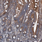 Immunohistochemical staining of human duodenum shows strong cytoplasmic positivity in glandular cells.
