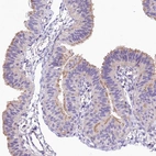 Immunohistochemical staining of human fallopian tube shows moderate positivity in apical membrane in glandular cells.