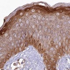Immunohistochemical staining of human skin using Anti-HAL antibody HPA038548.