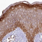 Immunohistochemical staining of human skin using Anti-HAL antibody HPA038548.