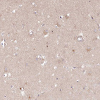 Immunohistochemical staining of human cerebral cortex shows weak cytoplasmic positivity in neurons.