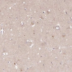 Immunohistochemical staining of human cerebral cortex shows weak cytoplasmic positivity in neurons.