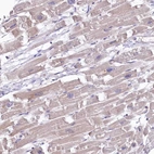 Immunohistochemical staining of human heart muscle shows weak cytoplasmic positivity in cardiomyocytes.