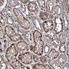 Immunohistochemical staining of human kidney shows strong cytoplasmic positivity in cells in tubules.