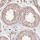 Immunohistochemical staining of human testis shows moderate cytoplasmic positivity.