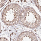 Immunohistochemical staining of human testis shows moderate cytoplasmic positivity.