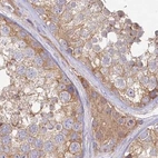 Immunohistochemical staining of human testis using Anti-HAL antibody HPA038548.