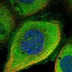 Immunofluorescent staining of human cell line A-431 shows localization to plasma membrane & cytosol.