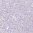Immunohistochemical staining of human liver shows no positivity in hepatocytes as expected.