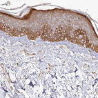 Immunohistochemical staining of human skin shows moderate cytoplasmic positivity in epidermal cells.