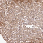 Immunohistochemical staining of human liver shows moderate cytoplasmic positivity in hepatocytes.