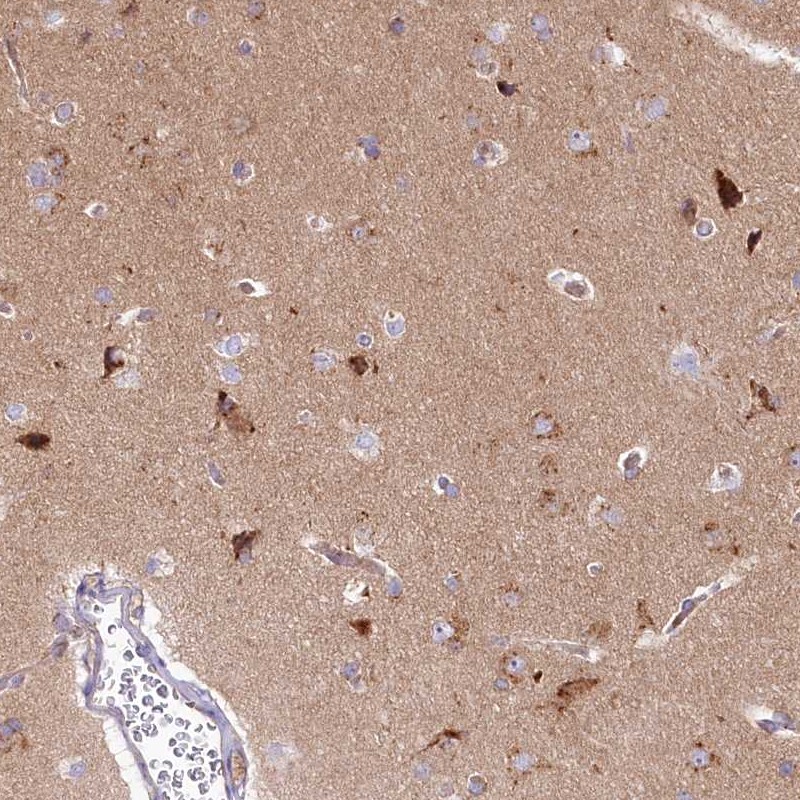 Anti-STX6 Antibody