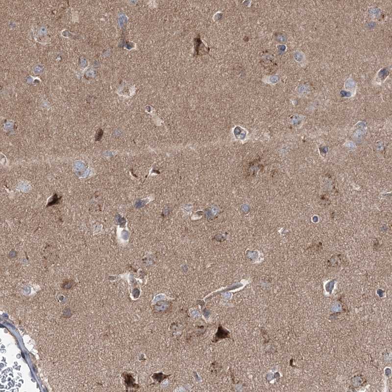 Anti-STX6 Antibody