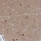 Anti-STX6 Antibody