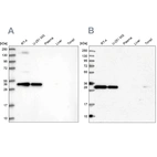 Western blot analysis using Anti-STX6 antibody HPA038557 (A) shows similar pattern to independent antibody HPA038558 (B).