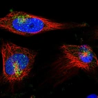 Immunofluorescent staining of human cell line U-251 MG shows localization to nucleoplasm & the Golgi apparatus.