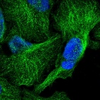 Immunofluorescent staining of human cell line U-2 OS shows localization to cytosol & microtubules.