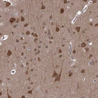 Anti-CCDC92 Antibody