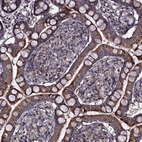 Immunohistochemical staining of human small intestine shows strong cytoplasmic positivity in glandular cells.