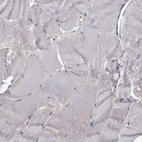 Immunohistochemical staining of human skeletal muscle shows no cytoplasmic positivity in myocytes.