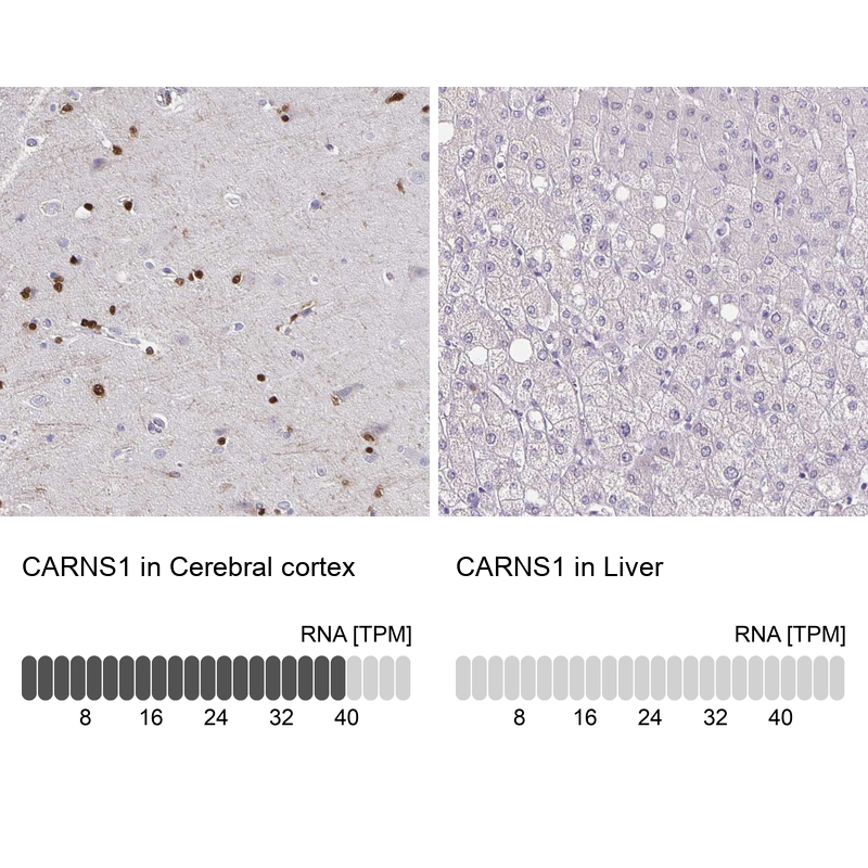Anti-CARNS1 Antibody