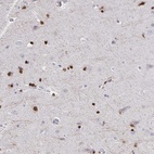 Immunohistochemical staining of human cerebral cortex shows high expression.