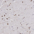 Immunohistochemical staining of human cerebral cortex shows high expression.