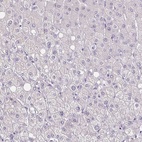 Immunohistochemical staining of human liver shows low expression as expected.